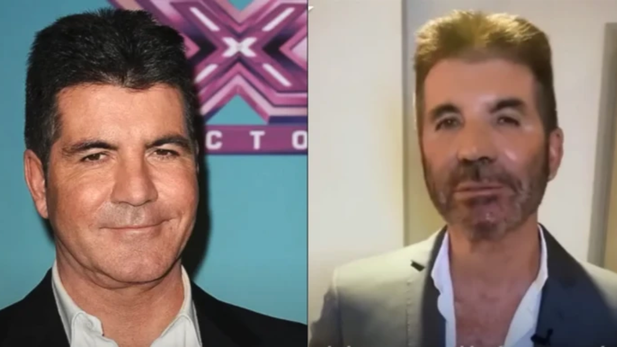 What Happened To Simon Cowells Face 